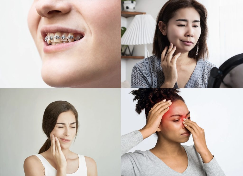 kinésithérapeute maxillo facial DTM orthodontie , paralysie faciale